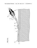 NEONATAL AND PEDIATRIC CATHETER SYSTEM diagram and image