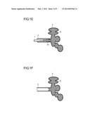 METHOD  FOR TREATMENT OF EMPHYSEMA diagram and image