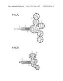 METHOD  FOR TREATMENT OF EMPHYSEMA diagram and image