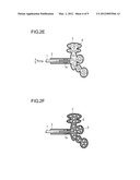 METHOD  FOR TREATMENT OF EMPHYSEMA diagram and image