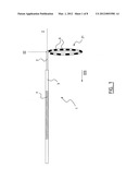 Ablation Catheter and Method for Electrically Isolating Cardiac Tissue diagram and image