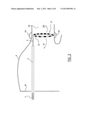 Ablation Catheter and Method for Electrically Isolating Cardiac Tissue diagram and image