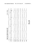 Ablation Catheter and Method for Electrically Isolating Cardiac Tissue diagram and image