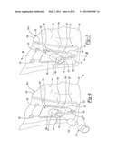 METHOD AND APPARATUS FOR OSTEOSYNTHESIS diagram and image