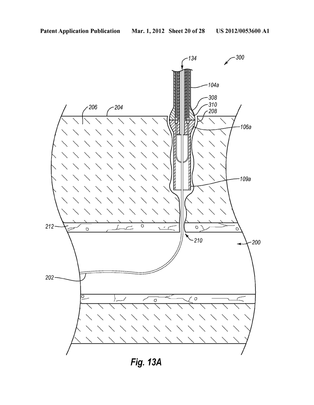 SUTURING DEVICES AND METHODS - diagram, schematic, and image 21