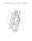 SELECTIVE TISSUE REMOVAL TOOL FOR USE IN MEDICAL APPLICATIONS AND METHODS     FOR MAKING AND USING diagram and image