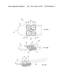 SELECTIVE TISSUE REMOVAL TOOL FOR USE IN MEDICAL APPLICATIONS AND METHODS     FOR MAKING AND USING diagram and image