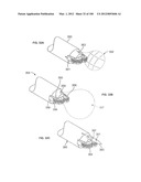 SELECTIVE TISSUE REMOVAL TOOL FOR USE IN MEDICAL APPLICATIONS AND METHODS     FOR MAKING AND USING diagram and image