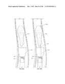 SELECTIVE TISSUE REMOVAL TOOL FOR USE IN MEDICAL APPLICATIONS AND METHODS     FOR MAKING AND USING diagram and image