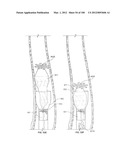 SELECTIVE TISSUE REMOVAL TOOL FOR USE IN MEDICAL APPLICATIONS AND METHODS     FOR MAKING AND USING diagram and image