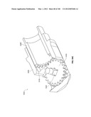 SELECTIVE TISSUE REMOVAL TOOL FOR USE IN MEDICAL APPLICATIONS AND METHODS     FOR MAKING AND USING diagram and image