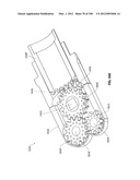 SELECTIVE TISSUE REMOVAL TOOL FOR USE IN MEDICAL APPLICATIONS AND METHODS     FOR MAKING AND USING diagram and image