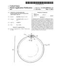 APPARATUS AND METHOD FOR INTRAGASTRIC BALLOON WITH IN SITU ADJUSTMENT     MEANS diagram and image