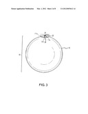 APPARATUS AND METHOD FOR INTRAGASTRIC BALLOON WITH IN SITU ADJUSTMENT     MEANS diagram and image