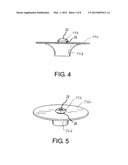 APPARATUS AND METHOD FOR INTRAGASTRIC BALLOON WITH IN SITU ADJUSTMENT     MEANS diagram and image