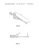 APPARATUS AND METHOD FOR INTRAGASTRIC BALLOON WITH IN SITU ADJUSTMENT     MEANS diagram and image