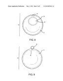 APPARATUS AND METHOD FOR INTRAGASTRIC BALLOON WITH IN SITU ADJUSTMENT     MEANS diagram and image