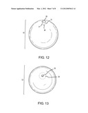 APPARATUS AND METHOD FOR INTRAGASTRIC BALLOON WITH IN SITU ADJUSTMENT     MEANS diagram and image