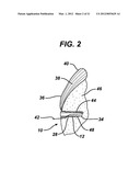 KNOTLESS SUTURE ANCHOR WITH UNTHREADED NOSE diagram and image