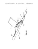 KNOTLESS SUTURE ANCHOR WITH UNTHREADED NOSE diagram and image