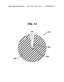 KNOTLESS SUTURE ANCHOR WITH UNTHREADED NOSE diagram and image