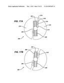 KNOTLESS SUTURE ANCHOR WITH UNTHREADED NOSE diagram and image