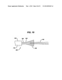 KNOTLESS SUTURE ANCHOR WITH UNTHREADED NOSE diagram and image