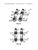 System and Method for Replacement of Spinal Motion Segment diagram and image