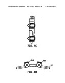 System and Method for Replacement of Spinal Motion Segment diagram and image