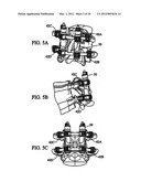 System and Method for Replacement of Spinal Motion Segment diagram and image