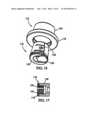 System and Method for Replacement of Spinal Motion Segment diagram and image