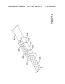 VERTEBRAL STABILIZATION TRANSITION CONNECTOR diagram and image