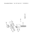 VERTEBRAL STABILIZATION TRANSITION CONNECTOR diagram and image