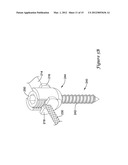 VERTEBRAL STABILIZATION TRANSITION CONNECTOR diagram and image