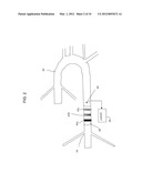 Correction and Optimization of Wave Reflection In Blood Vessels diagram and image