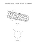 BIOERODIBLE ENDOPROSTHESES AND METHODS OF MAKING THE SAME diagram and image