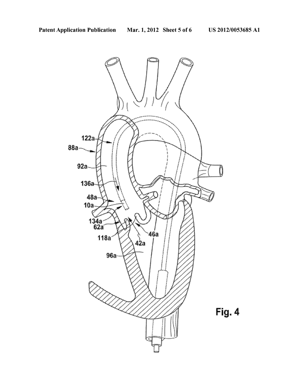 MEDICAL VALVE IMPLANT FOR IMPLANTATION IN AN ANIMAL BODY AND/OR HUMAN BODY - diagram, schematic, and image 06