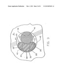 GRAFT LIGAMENT ANCHOR AND METHOD FOR ATTACHING A GRAFT LIGAMENT TO A BONE diagram and image