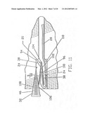 GRAFT LIGAMENT ANCHOR AND METHOD FOR ATTACHING A GRAFT LIGAMENT TO A BONE diagram and image