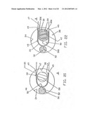 GRAFT LIGAMENT ANCHOR AND METHOD FOR ATTACHING A GRAFT LIGAMENT TO A BONE diagram and image