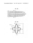 GRAFT LIGAMENT ANCHOR AND METHOD FOR ATTACHING A GRAFT LIGAMENT TO A BONE diagram and image