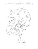 Acetabular Cup Having Deformation Resistant Features diagram and image