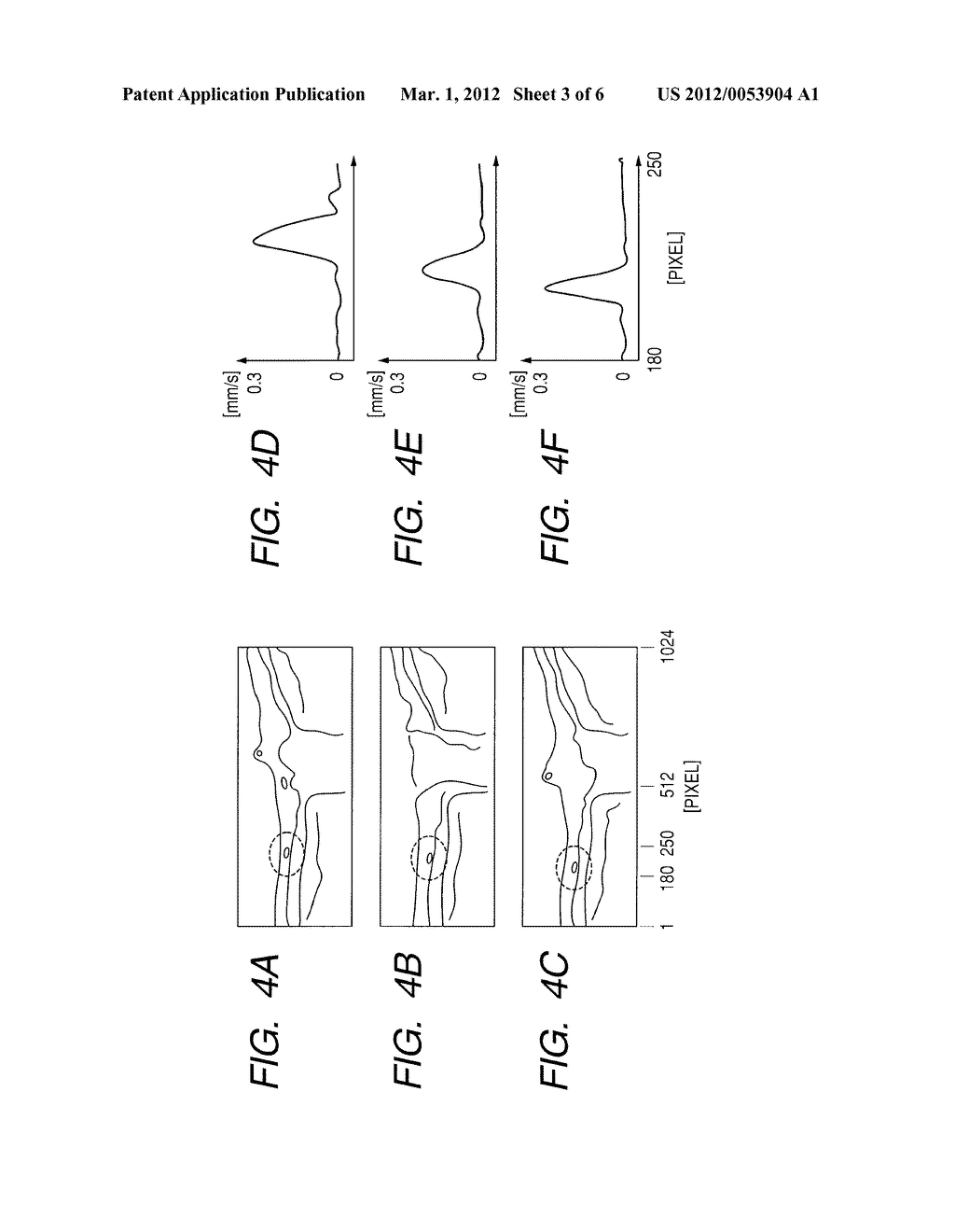 INFORMATION PROCESSING APPARATUS IN OCT SYSTEM - diagram, schematic, and image 04