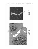 Method and System For Patient-Specific Modeling of Blood Flow diagram and image