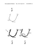 Method and System For Patient-Specific Modeling of Blood Flow diagram and image