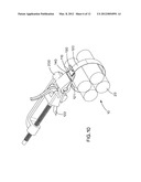 Buckle With Strapping Supports diagram and image