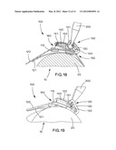 Buckle With Strapping Supports diagram and image