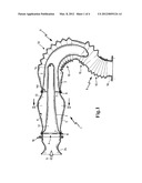 FILTER PIPLINE diagram and image