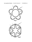 FILTER PIPLINE diagram and image