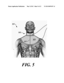 Device For Stimulating Adaptive Thermogenesis in Brown Adipose Tissue diagram and image